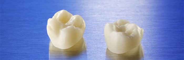 teeth translucent cracking teeth translucent cracking